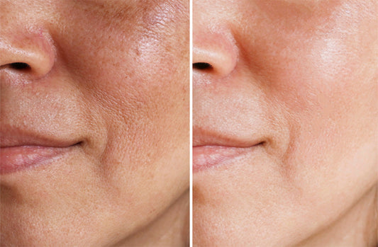 Can You Reverse Aging? 8 Ways to Reduce Premature Aging