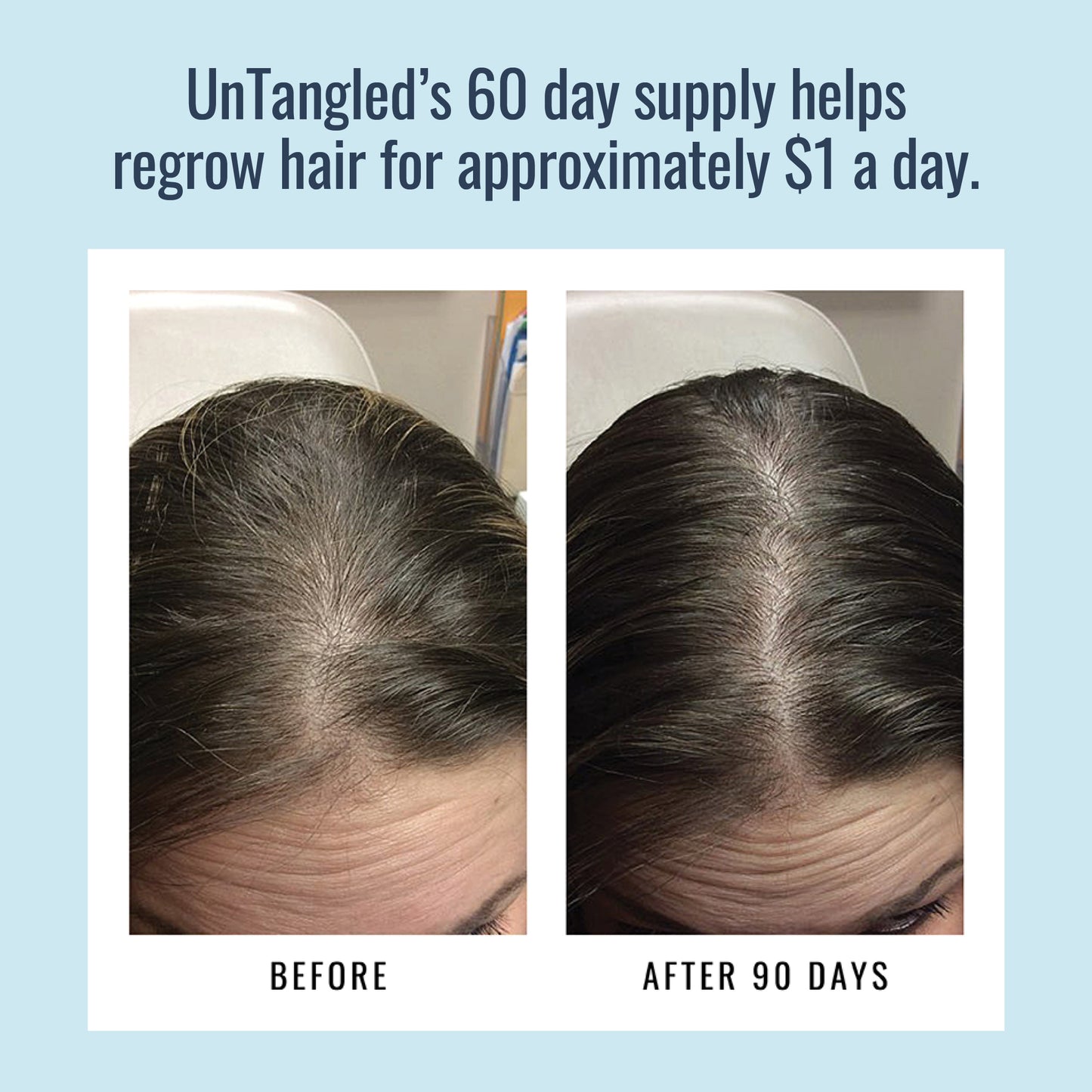 Before and after using UnTangled Hair Supplement - 90 Day Results