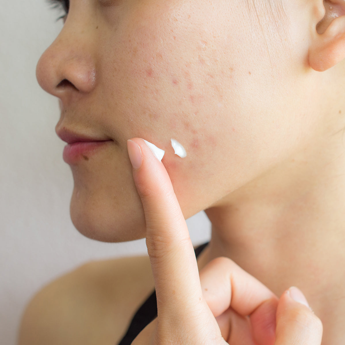 Woman using 20% Vitamin C Face Lotion to help with fine lines & wrinkles to renew and firm your skin