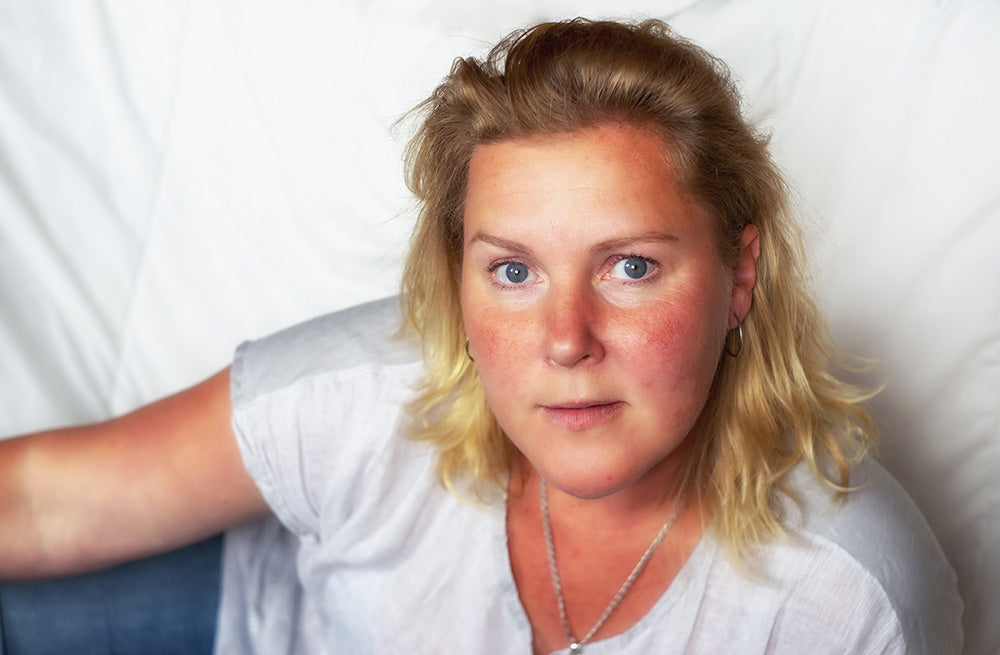 Can You Use Azelaic Acid for Rosacea & How Does It Help?