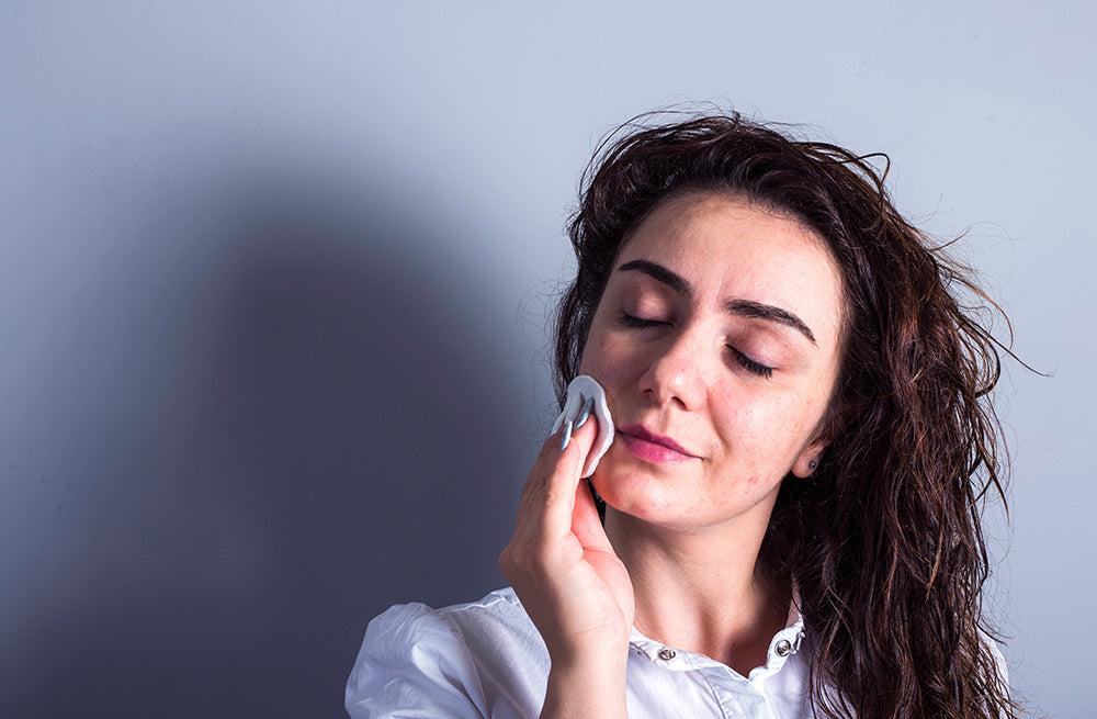 Woman with eyes closed and acne