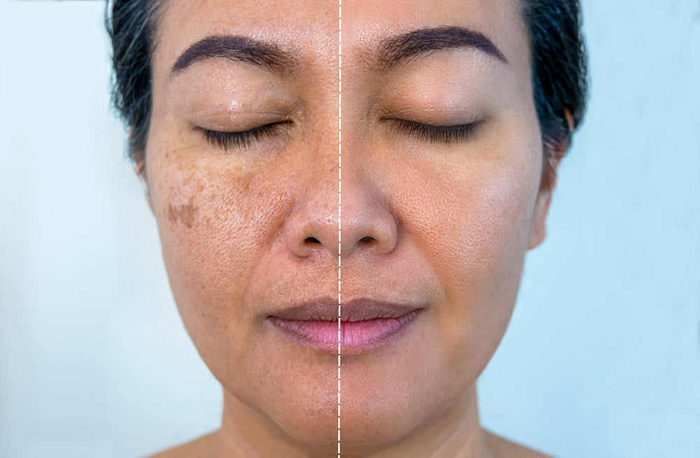 Ask The Dermatologist: What are the Best Products to Use to Reduce Dark Spots & Even Skin Tone?