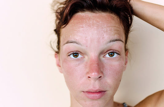 Ask The Dermatologist: Can You Reverse Sun Damage On Your Skin?