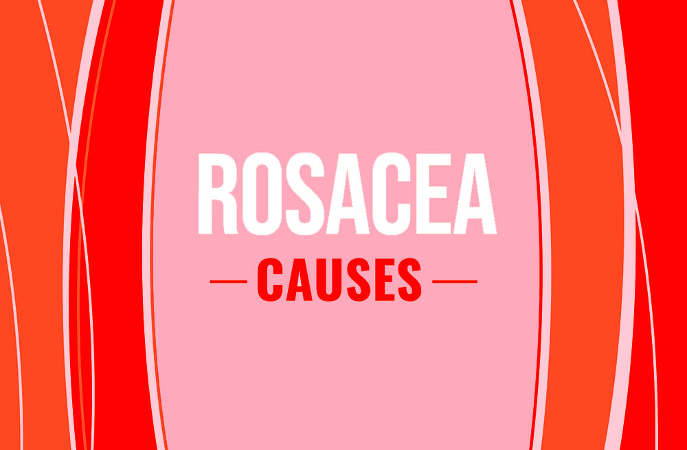 Rosacea causes word graphic illustration