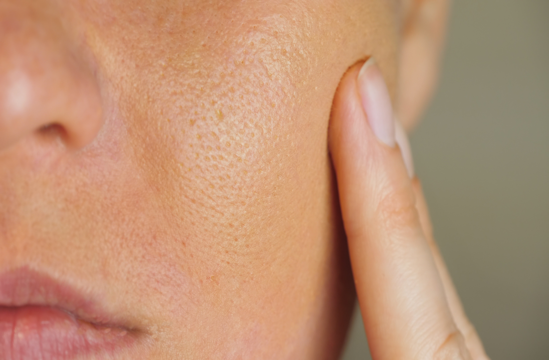 How to Unclog Your Pores and Keep Them Clear