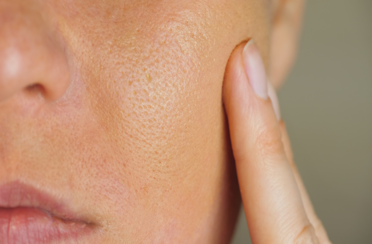 How to Unclog Your Pores and Keep Them Clear