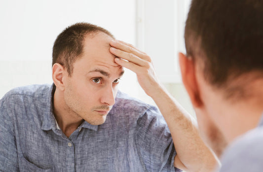 Male Pattern Baldness Explained - Symptoms & Causes