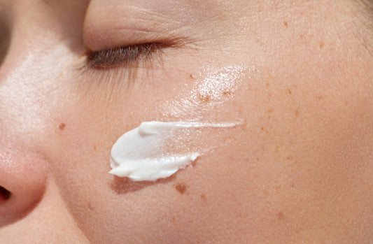 Niacinamide for Hyperpigmentation: What Dermatologists and Clinical Studies Say