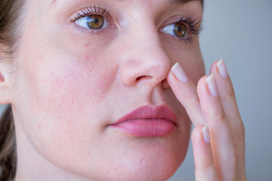 4 Different Types of Rosacea