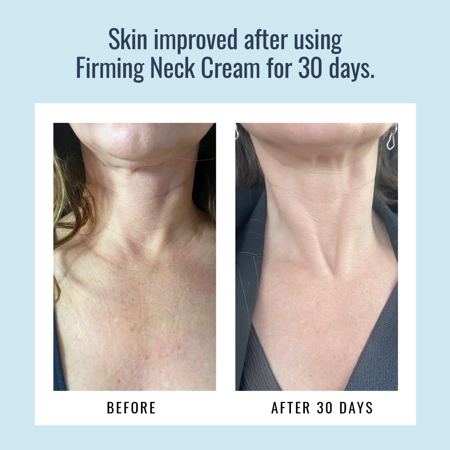 Firming Neck Cream